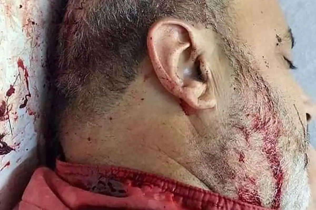 (تصاویر +16) حمله با شمشیر به نماینده پارلمان تونس