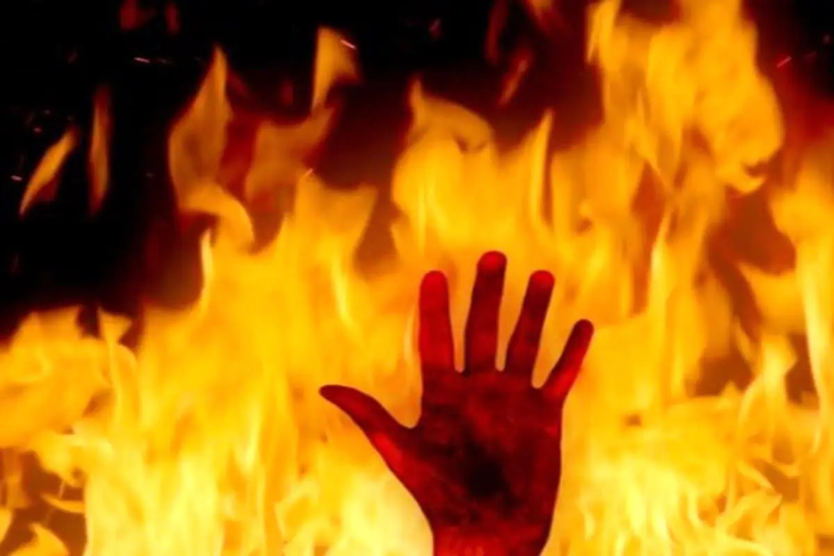 زن جوان توسط همسرش به آتش کشیده شد