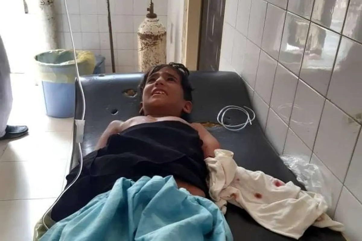 جدال نابرابر کودکان بلوچستان با «گاندو»