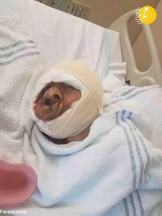 (تصاویر) تومور روی صورت مردِ شیطانی برداشته شد