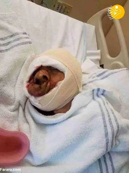 (تصاویر) تومور روی صورت مردِ شیطانی برداشته شد