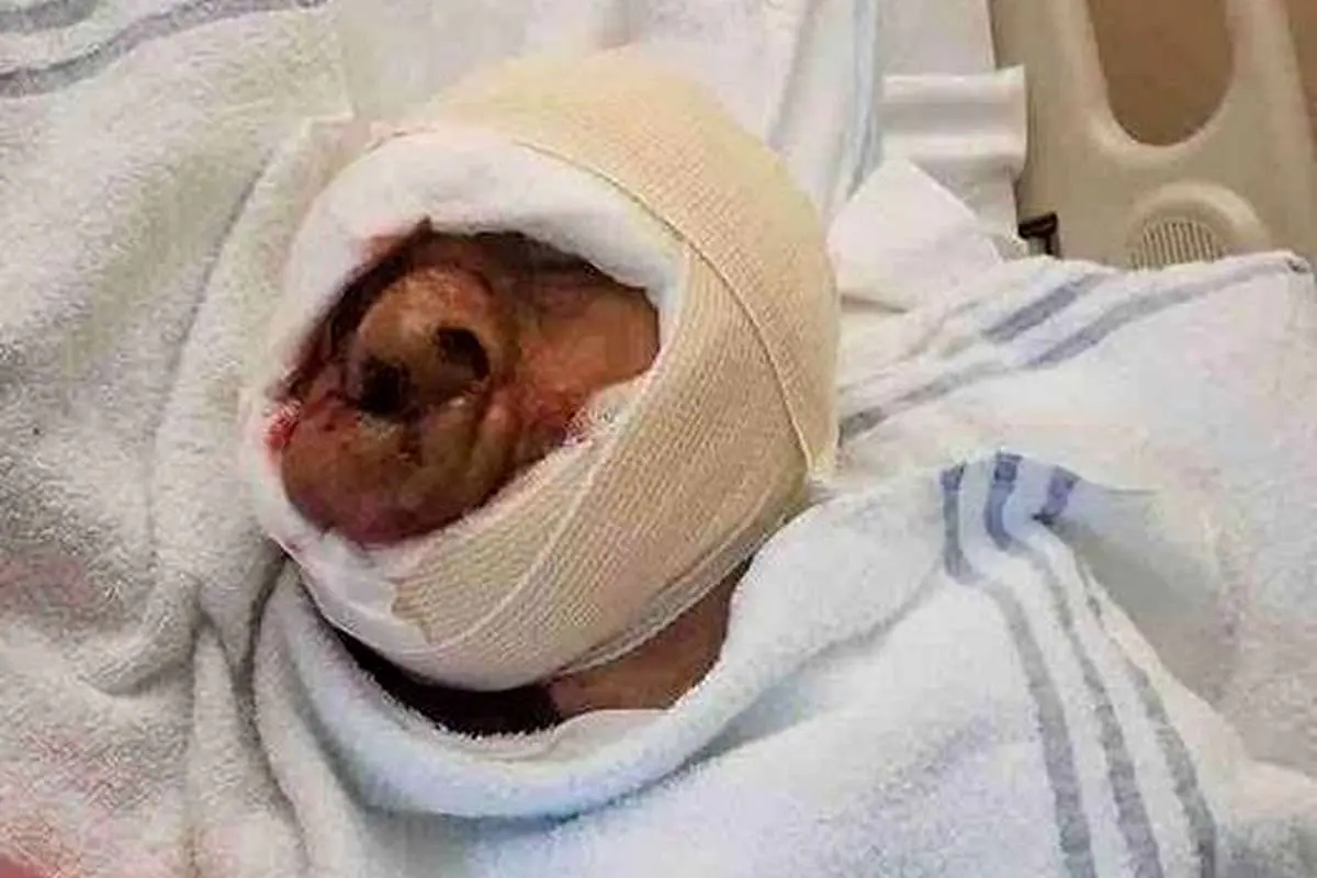 (تصاویر) تومور روی صورت مردِ شیطانی برداشته شد