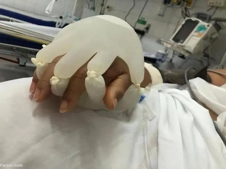(ویدئو) دست مصنوعی؛ ابتکاری برای تسلی بیماران کرونایی