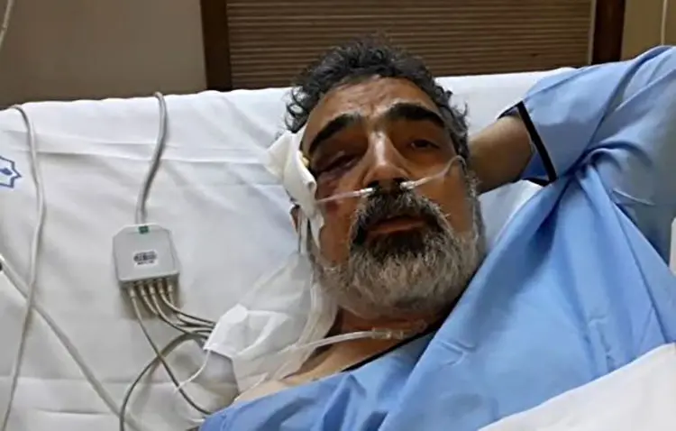 اولین تصاویر از سخنگوی انرژی اتمی پس از حادثه در نطنز