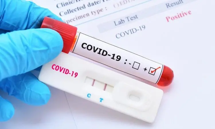 کرونای هندی سه تاجر در قم تایید شد