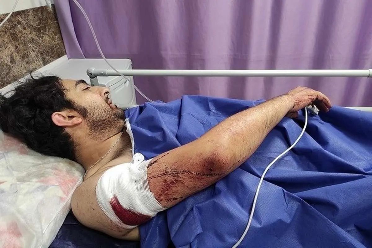 (تصویر) زورگیری خونین از یک عکاس خبری