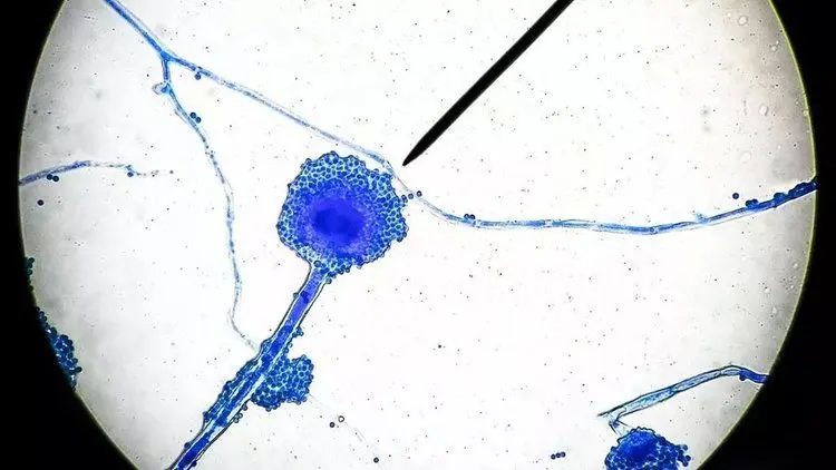 بیماری «قارچ سیاه» چیست و چگونه وارد بدن افراد می‌شود؟