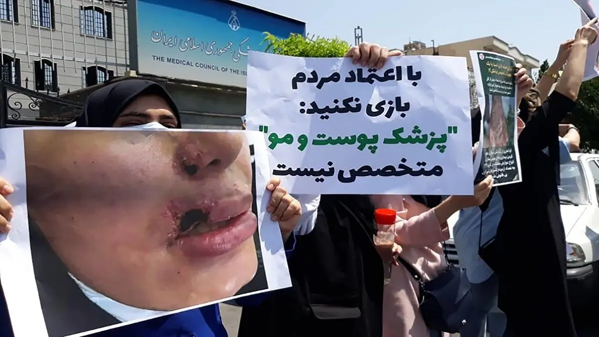 واکنش رئیس نظام پزشکی به اعتراض رزیدنت‌های پوست