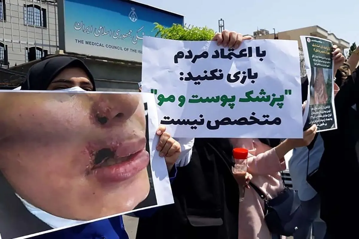 واکنش رئیس نظام پزشکی به اعتراض رزیدنت‌های پوست