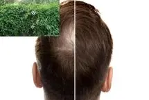 درمان طبیعی طاسی با یک گیاه اسرارآمیز چینی