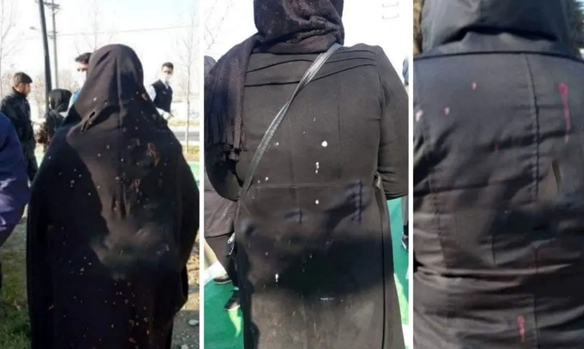 (ویدئو) اعترافات متهم اسیدپاشی پارک شهریار