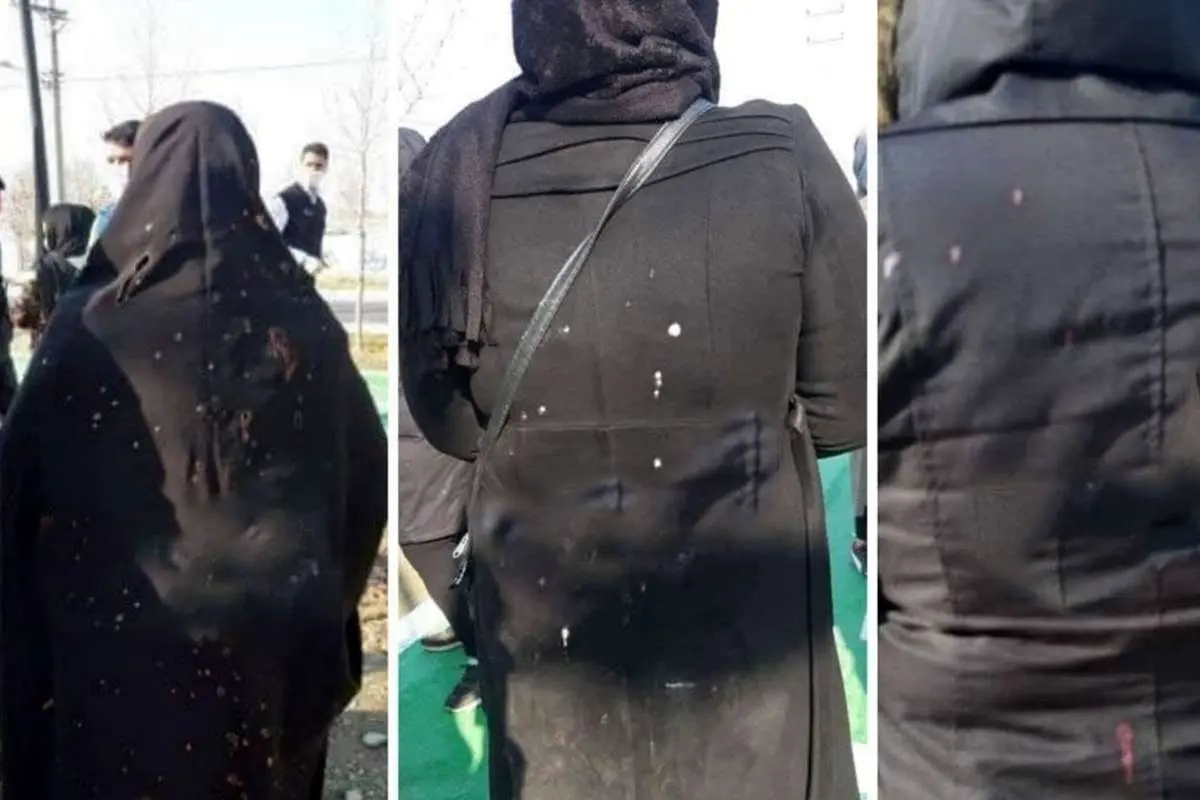 (ویدئو) اعترافات متهم اسیدپاشی پارک شهریار