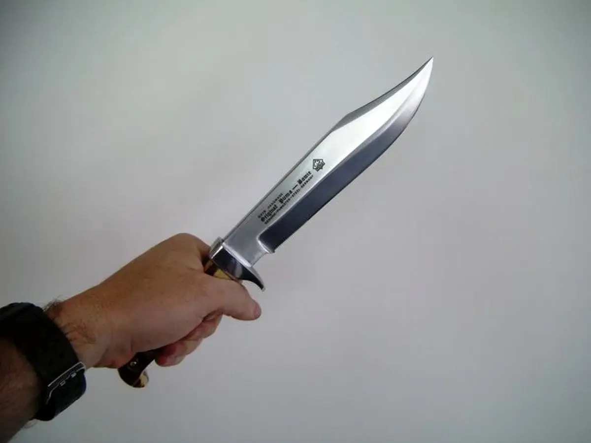 شوهرم چشمم را کور و دستم را قطع کرد؛ قصاص می‌خواهم