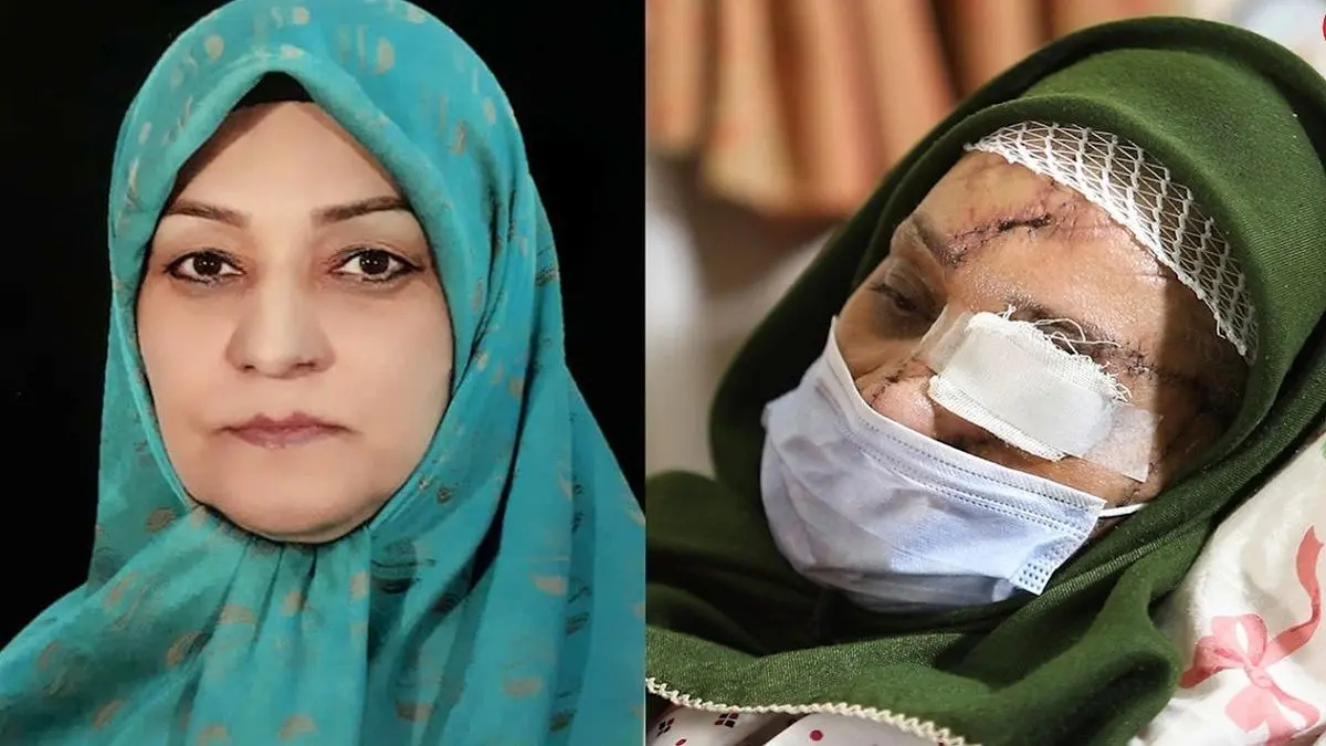 اظهارات دردناک زن شکنجه‌دیده در جلسه محاکمه شوهر