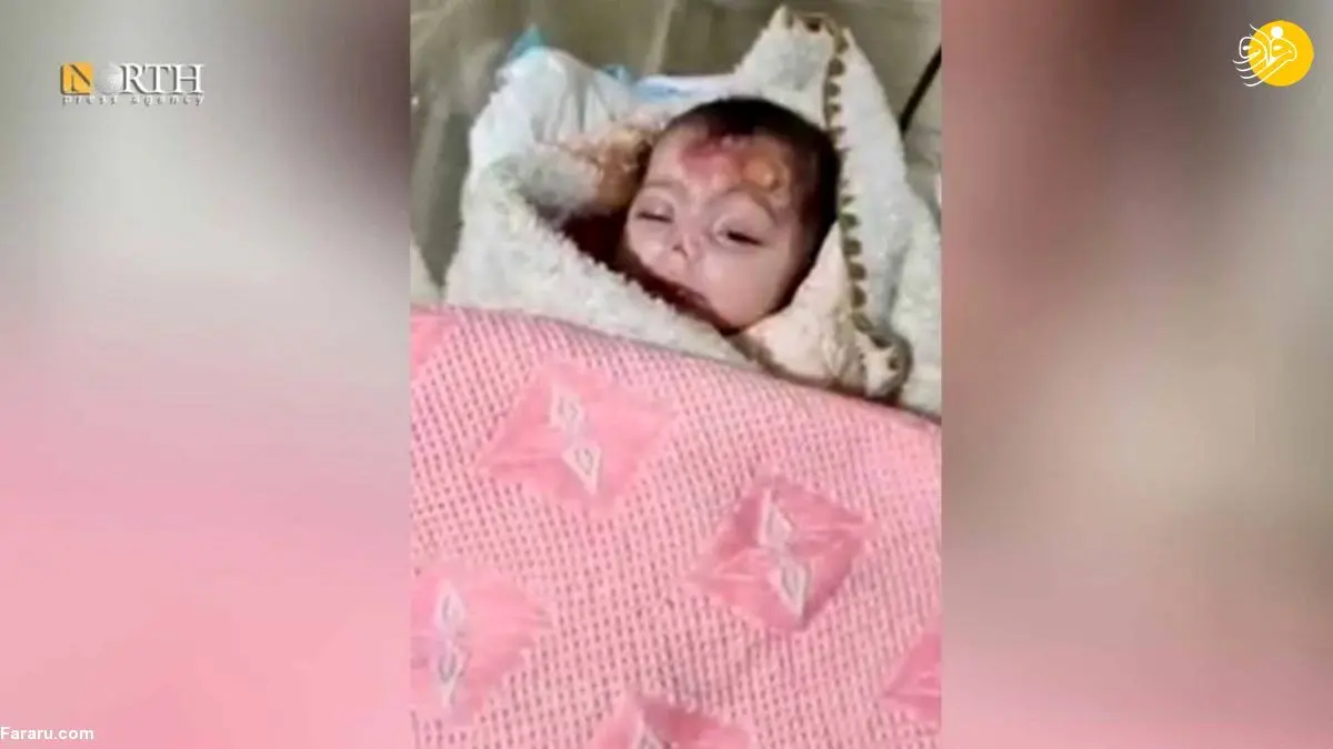 (تصاویر) موش‌ها بینی نوزاد دختر را جویدند!