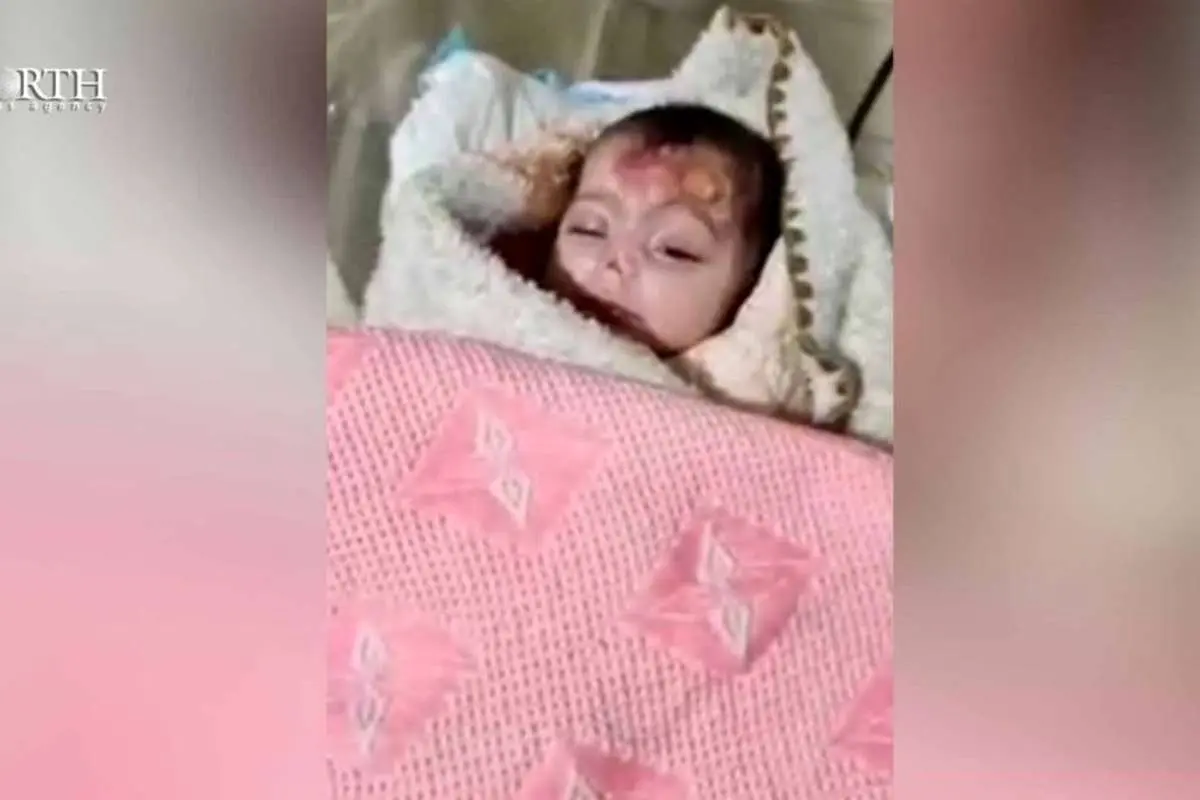 (تصاویر) موشها بینی نوزاد دختر را جویدند!
