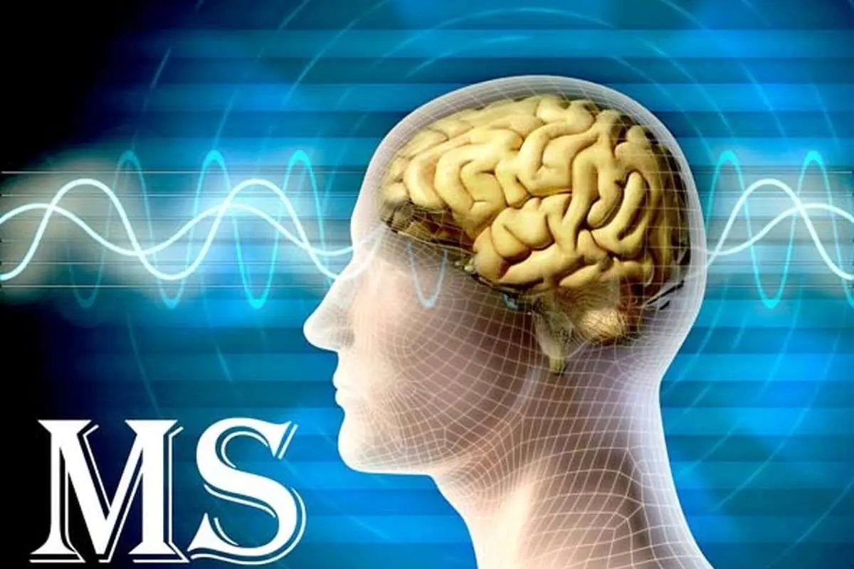 پژوهش جدید: ویروس «بیماری بوسه» عامل اصلی «ام اس» است