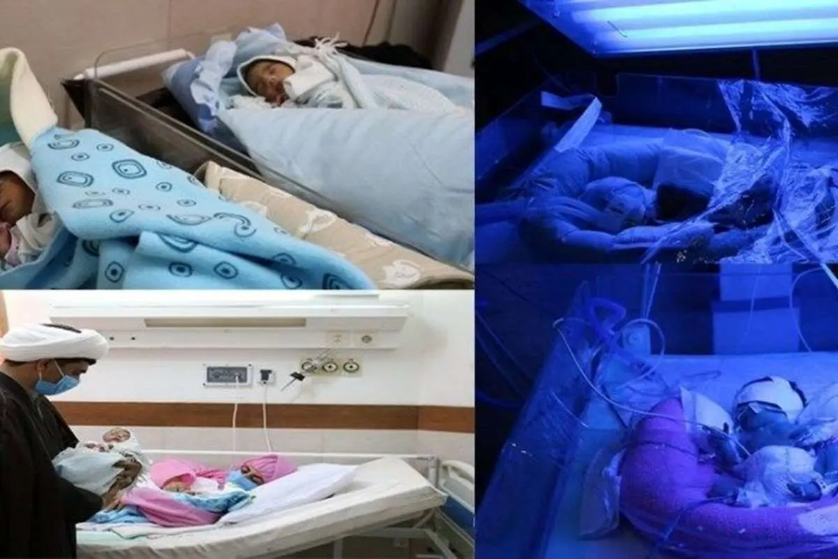 مادر کرمانی در دومین زایمان خود چهار قلو به دنیا آورد