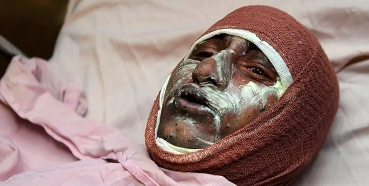 هنوز چهارشنبه سوری شروع نشده، ۱۰ نفر جان‌باختند