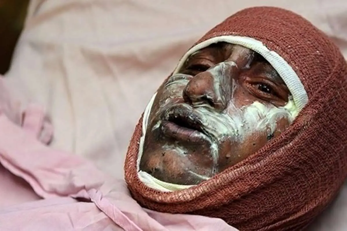 هنوز چهارشنبه سوری شروع نشده، ۱۰ نفر جانباختند