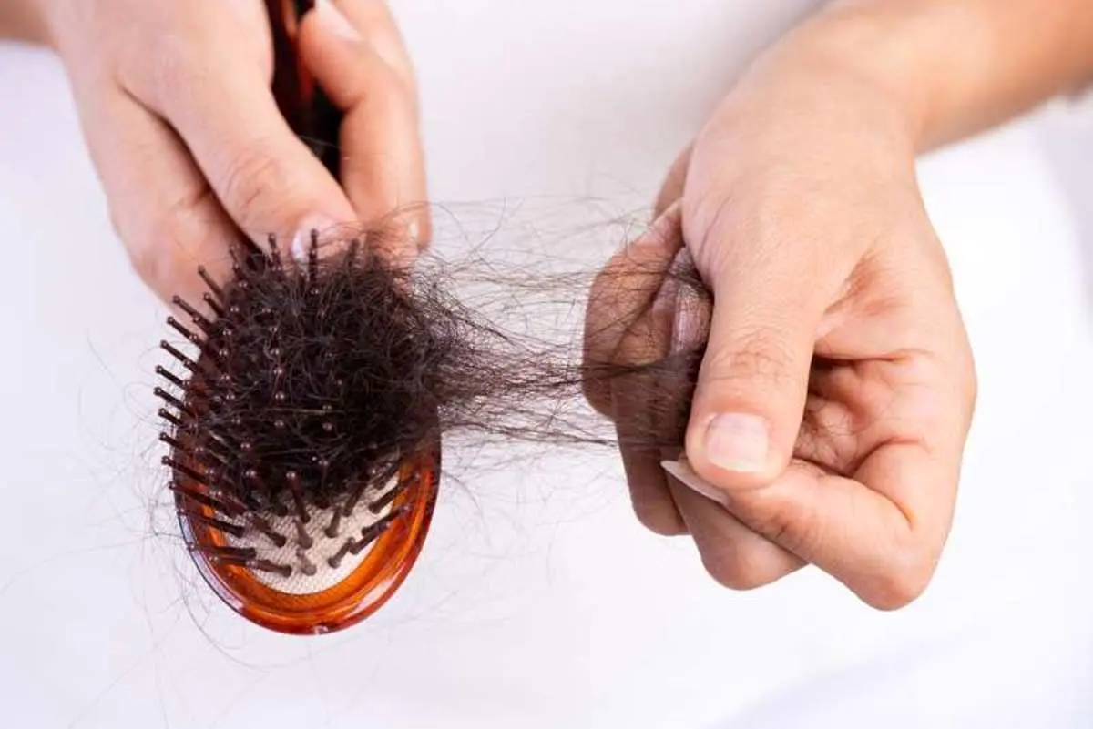 جلوگیری از ریزش مو با این توصیه ساده طب سنتی