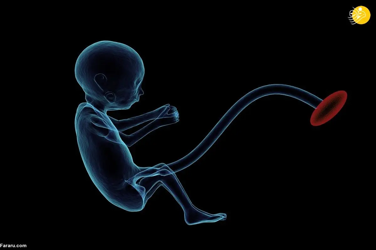 غربالگری جنین محدود شد؟