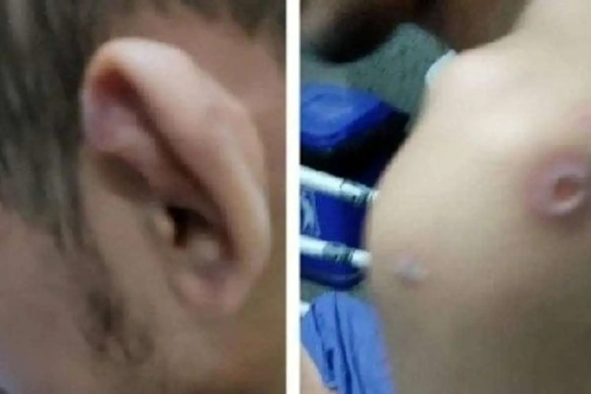 آزار و اذیت یک ناتوان ذهنی در قائم‌شهر