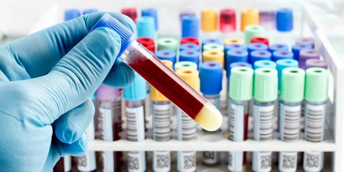 پیش‌بینی زوال عقل از طریق آزمایش خون