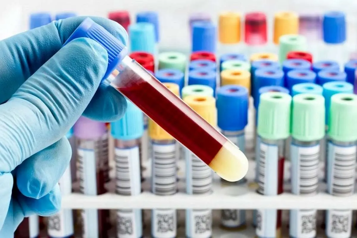 پیشبینی زوال عقل از طریق آزمایش خون