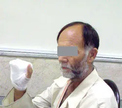 عکس> سارق پس از قطع انگشتان به قتل متهم شد