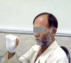 عکس> سارق پس از قطع انگشتان به قتل متهم شد