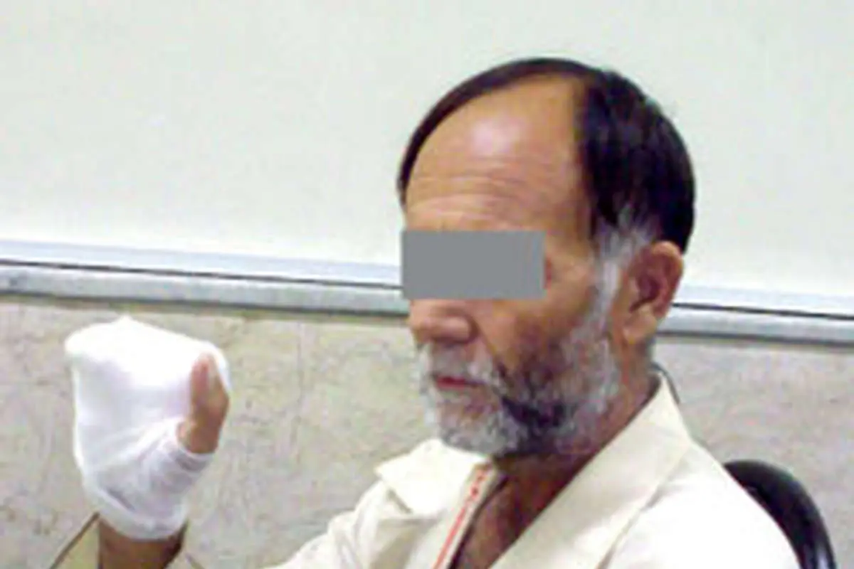 عکس> سارق پس از قطع انگشتان به قتل متهم شد