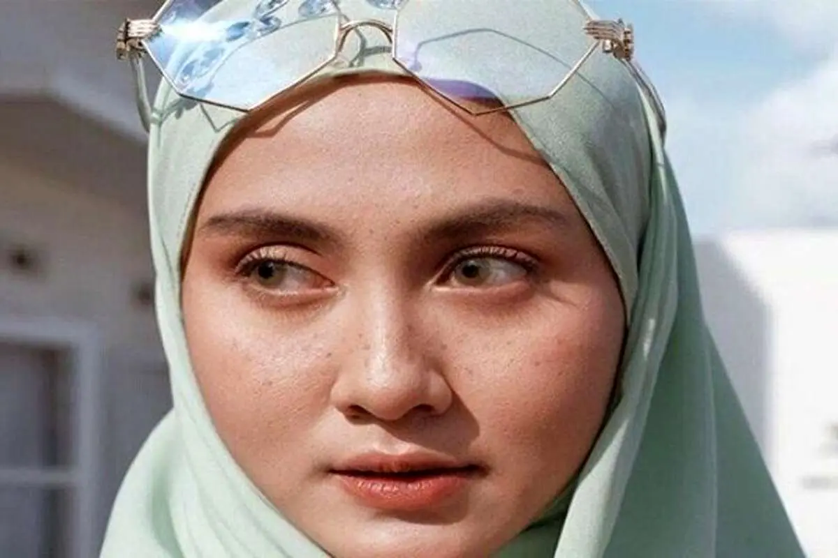 تفاوت بین لکه پوستی مادرزادی، خال و ککومک چیست؟