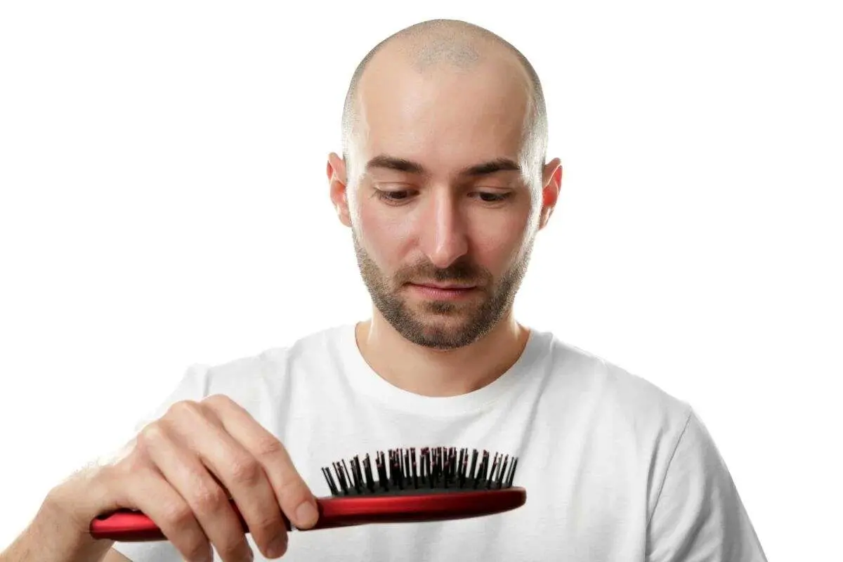علت افزایش ریزش مو بین ایرانیها