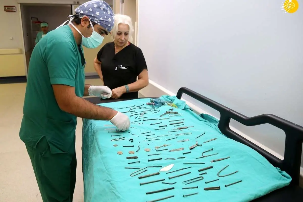 (ویدئو) از ناخنگیر تا چاقو؛ خارج کردن ۱۵۸ شیء فلزی از معده یک زن!