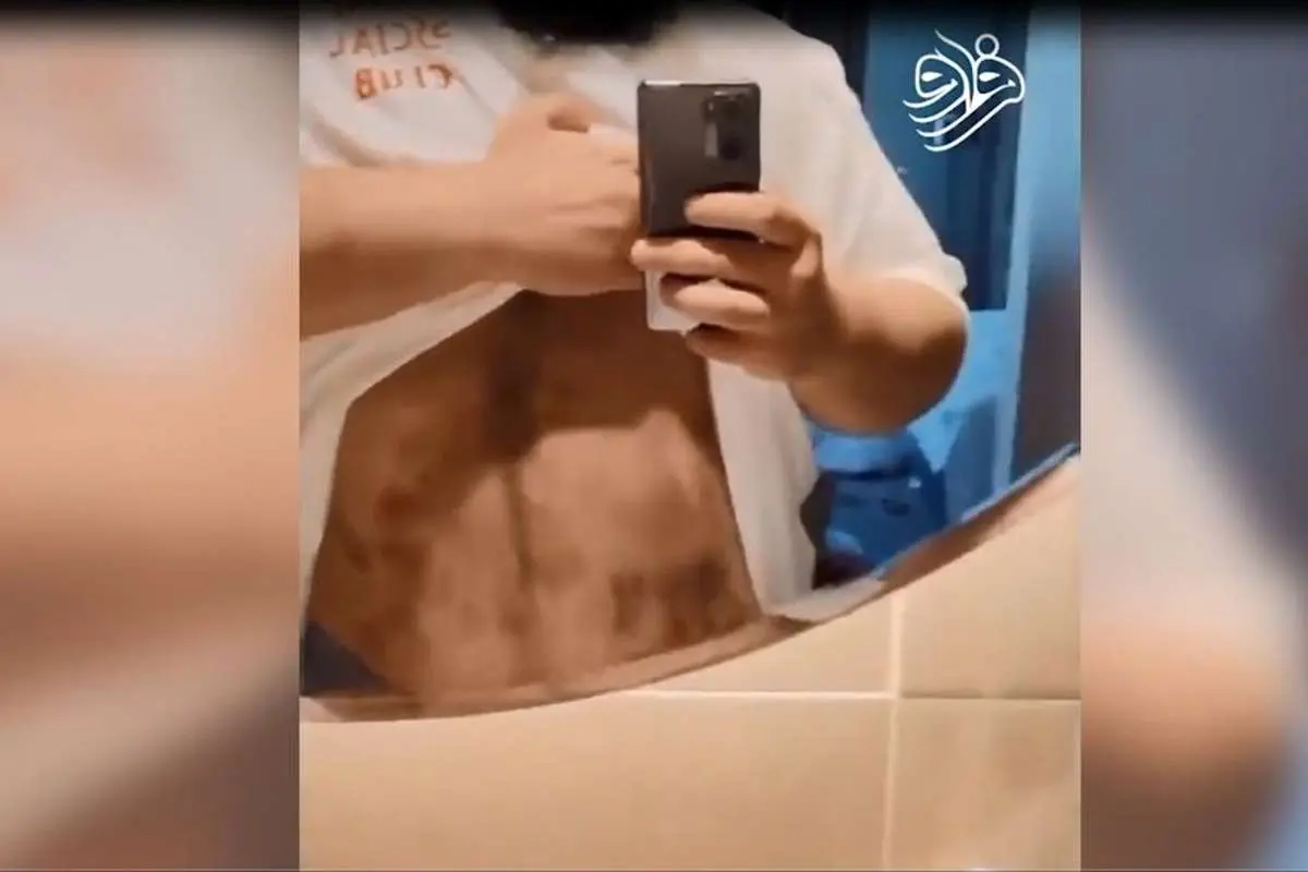 (ویدئو) ماجرای شایعه ضرب و شتم هالک ایرانی؛ علت کبودی و زخم چه بود؟