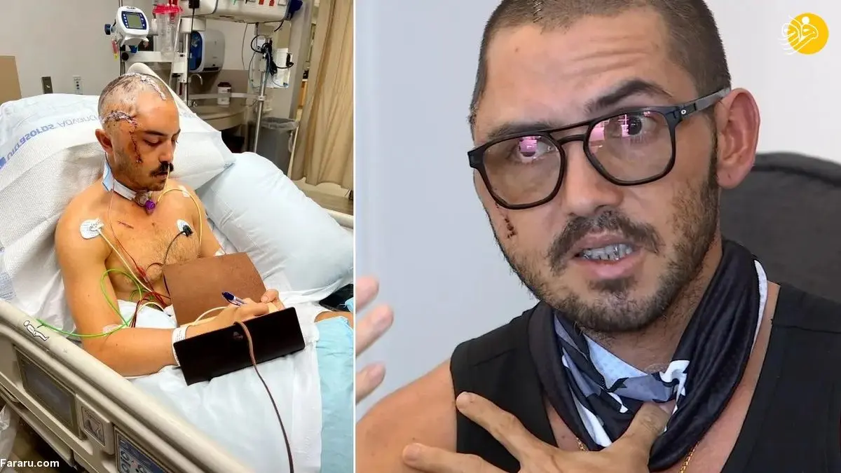 (ویدئو) تمساح جمجمه یک شناگر را له کرد!