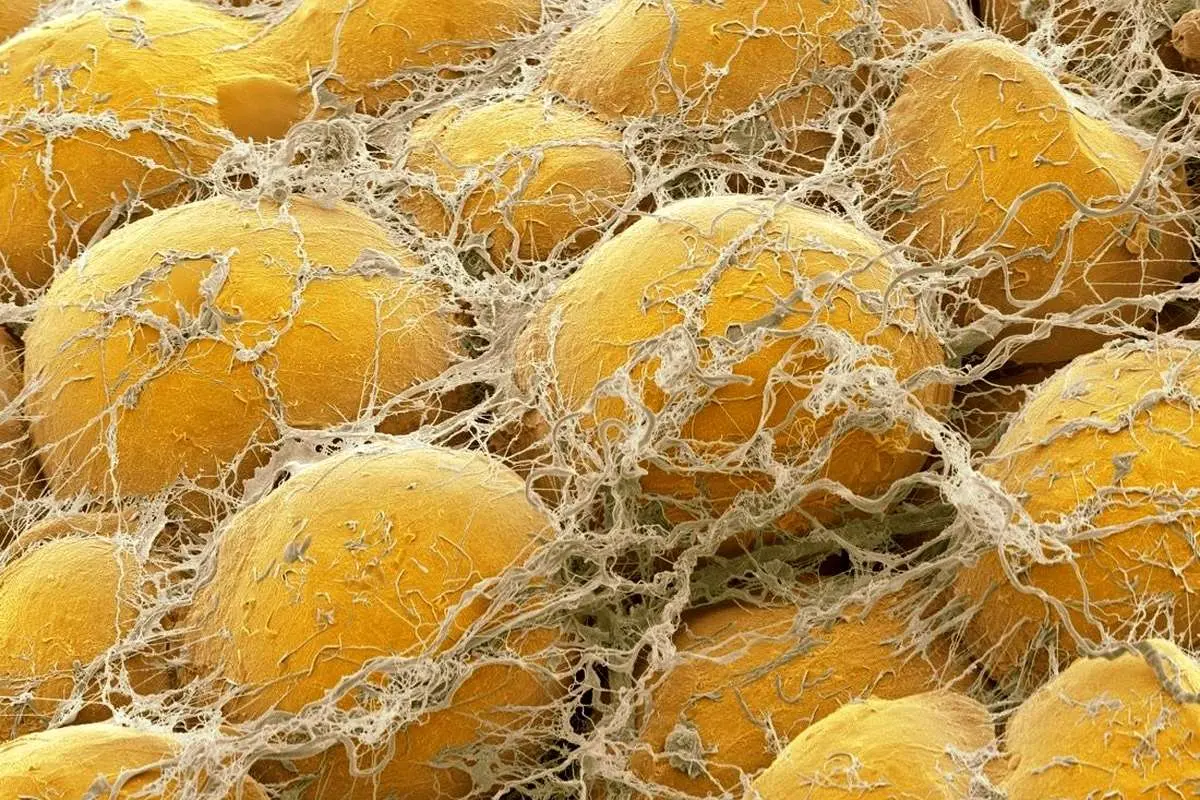 راههایی برای بهبود چربی سالم بدن، بدون کاهش وزن