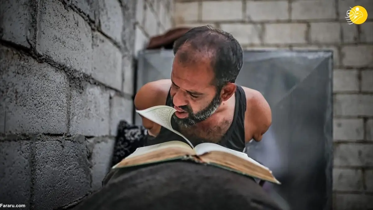 (تصاویر) روزگار سخت مرد سوری با دو دست قطع شده