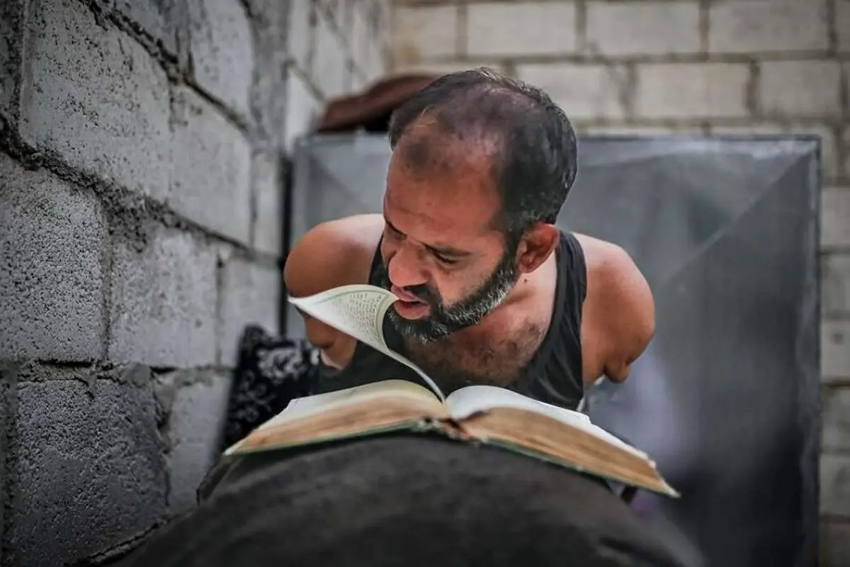 (تصاویر) روزگار سخت مرد سوری با دو دست قطع شده