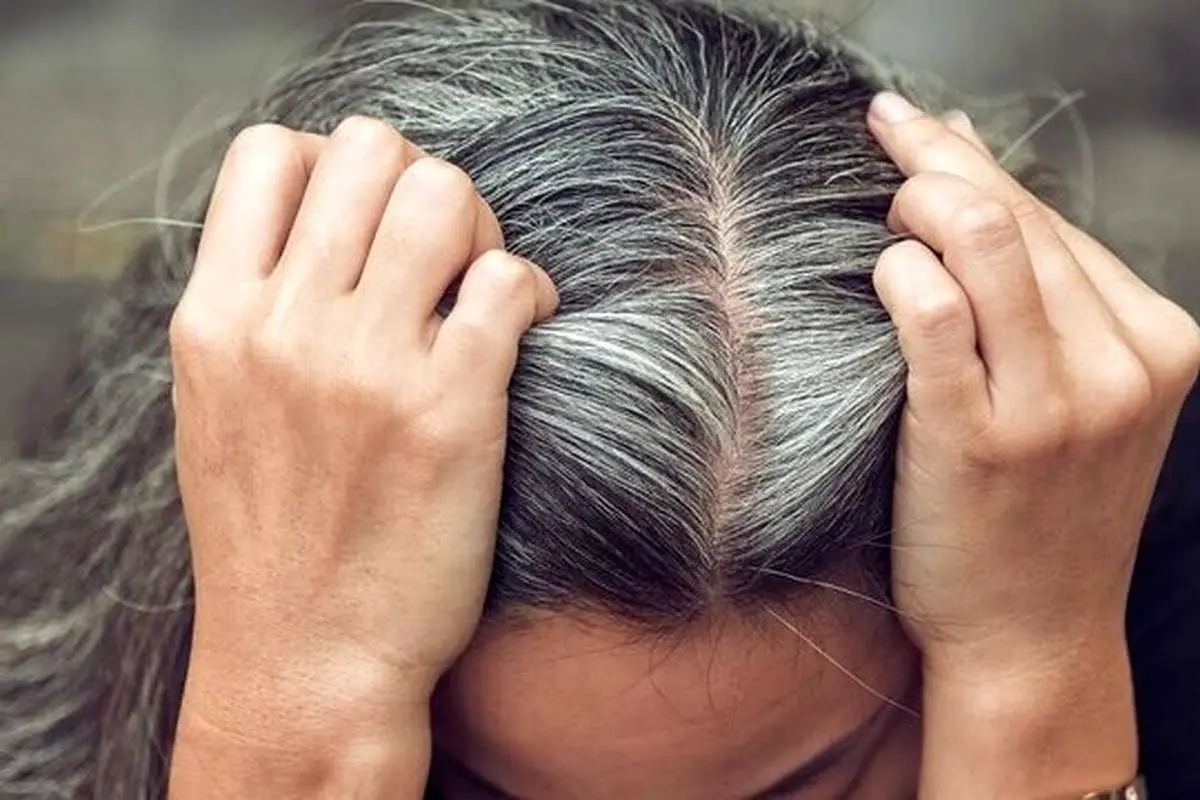 آیا استرس واقعا عامل سفیدشدن مو است؟