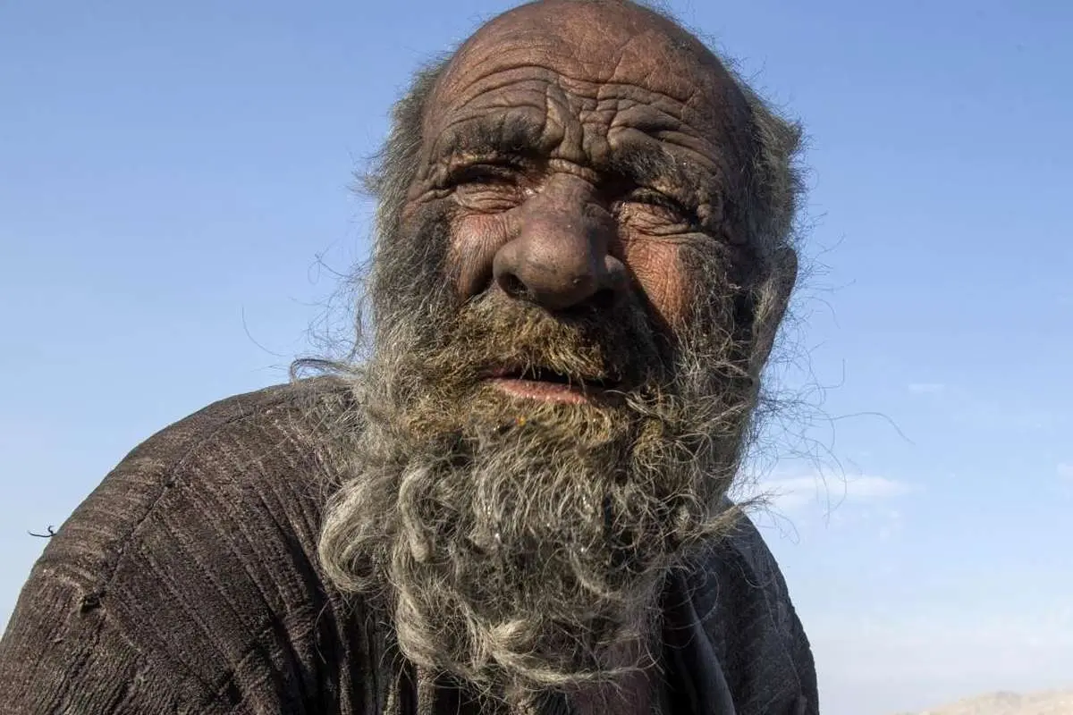 (عکس) گزارش رسانه خارجی از کثیفترین مرد جهان