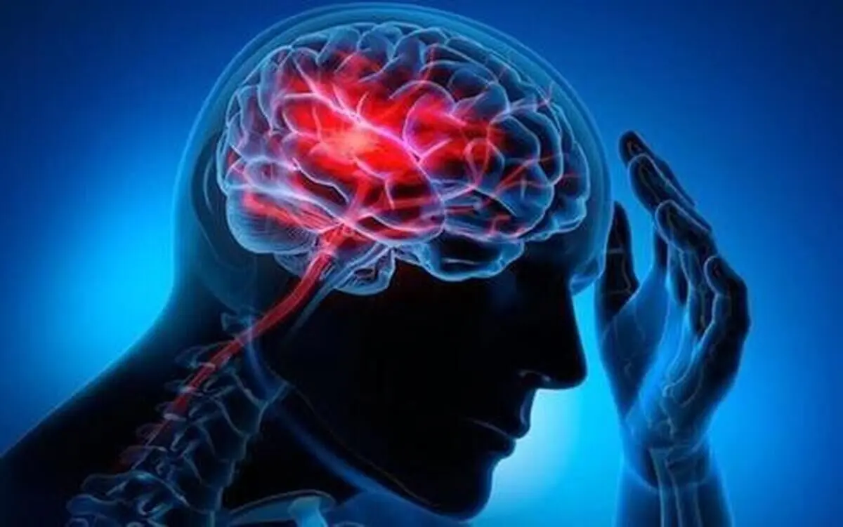 چند راهکار ساده برای پیشگیری از سکته مغزی