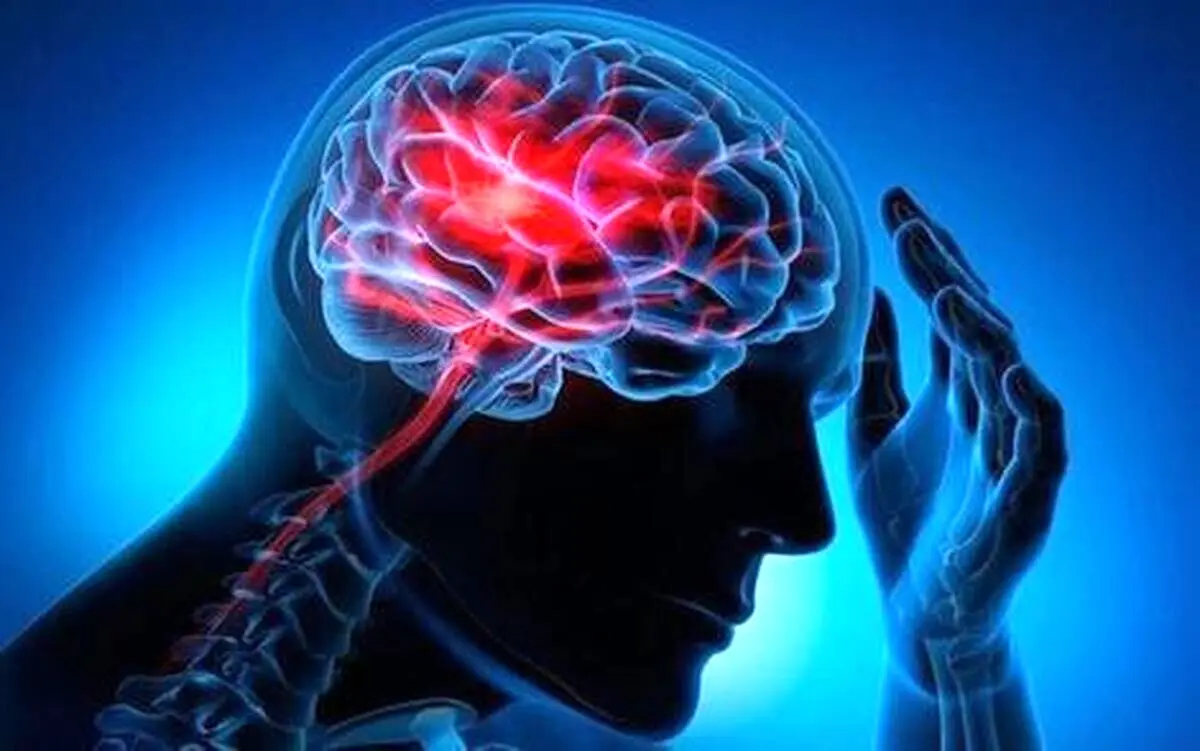 چند راهکار ساده برای پیشگیری از سکته مغزی
