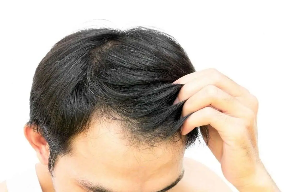 چند ترفند ساده برای جلوگیری از ریزش مو