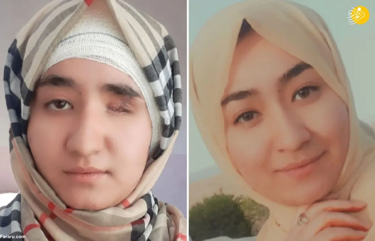 (ویدئو) شاهکار دختر هزاره بازمانده از انفجار انتحاری