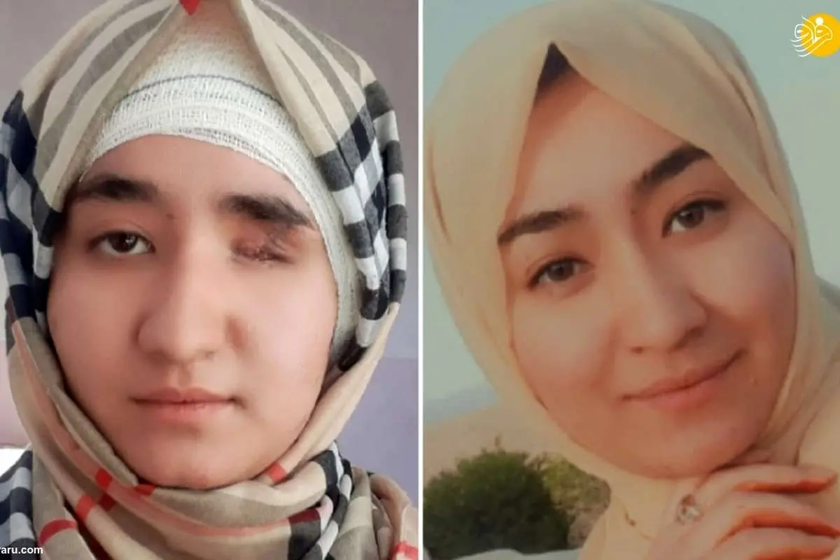 (ویدئو) شاهکار دختر هزاره بازمانده از انفجار انتحاری