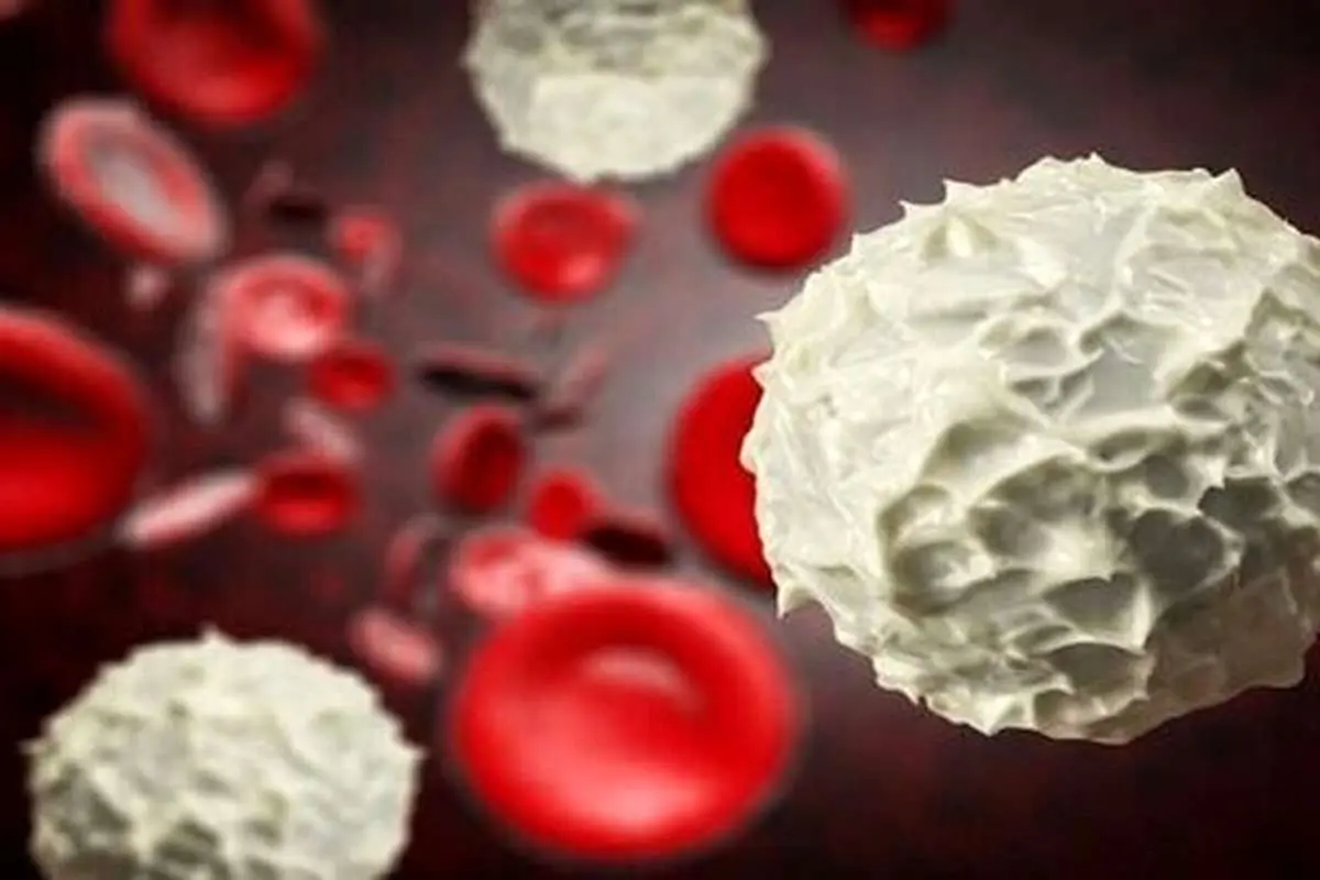 آیا سرطان آپاندیس ارثی است؟