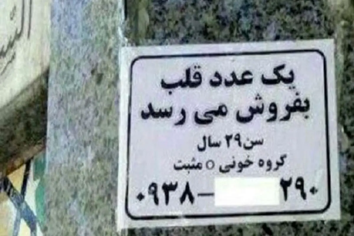 خرید و فروش کلیه و اعضای بدن از سر استیصال؟