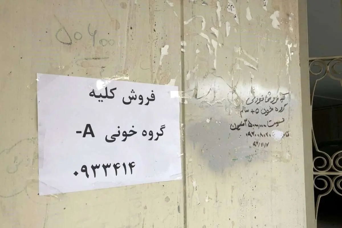 خرید و فروش کلیه و اعضای بدن برای معیشت!